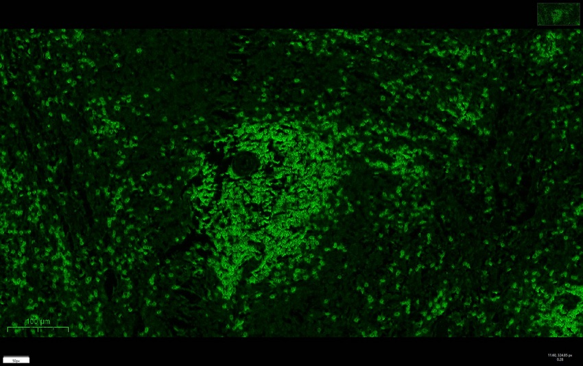 Recombinant CD3e/CD3 epsilon Monoclonal Antibody - small - 7