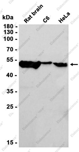 Recombinant beta IV Tubulin Monoclonal Antibody - 3