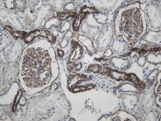 Recombinant CD239 Monoclonal Antibody - 2