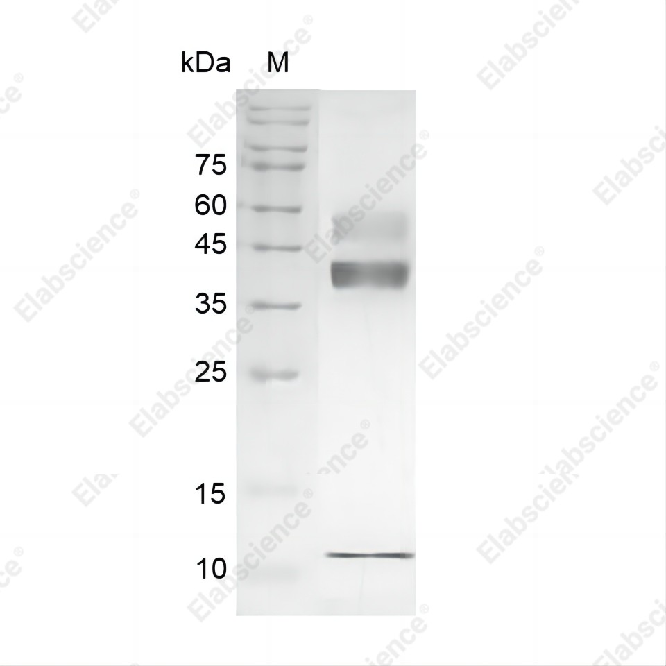Recombinant Human TGF beta 1 protein(His Tag) - 1