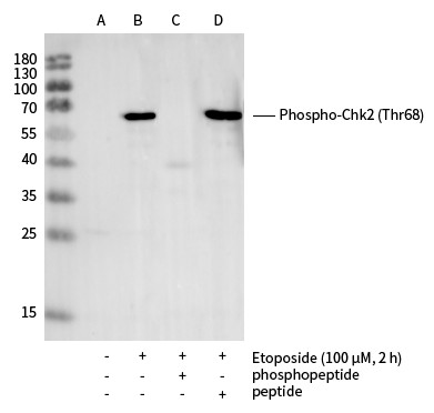 Recombinant Phospho-Chk2 (Thr68) Monoclonal Antibody - small - 2