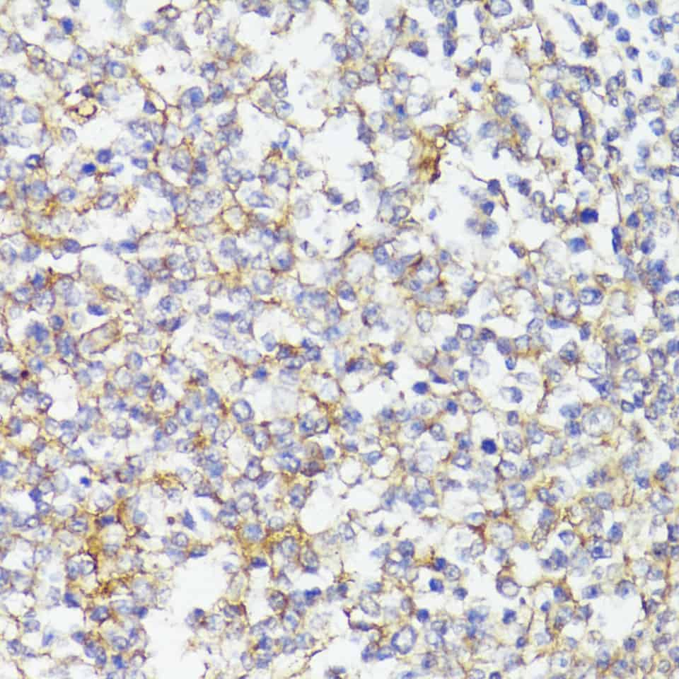 Immunohistochemistry of paraffin-embedded Human tonsil using CD276/B7-H3 Polyclonal Antibody at dilution of 1:100 (40x lens).Perform microwave antigen retrieval with 10 mM PBS buffer pH 7.2 before commencing with IHC staining protocol.