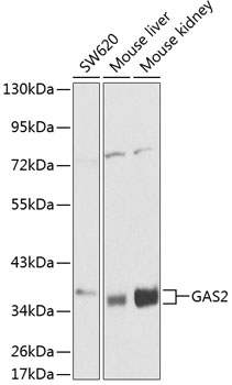 Western blot analysis of extracts of various cell lines using GAS2 Polyclonal Antibody at 1:1000 dilution.