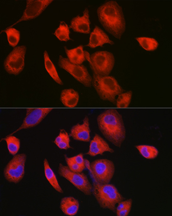 Immunofluorescence analysis of RD cells using MYH7/β-MHC Polyclonal Antibody at dilution of 1:150 (40x lens). Blue:DAPI for nuclear staining.