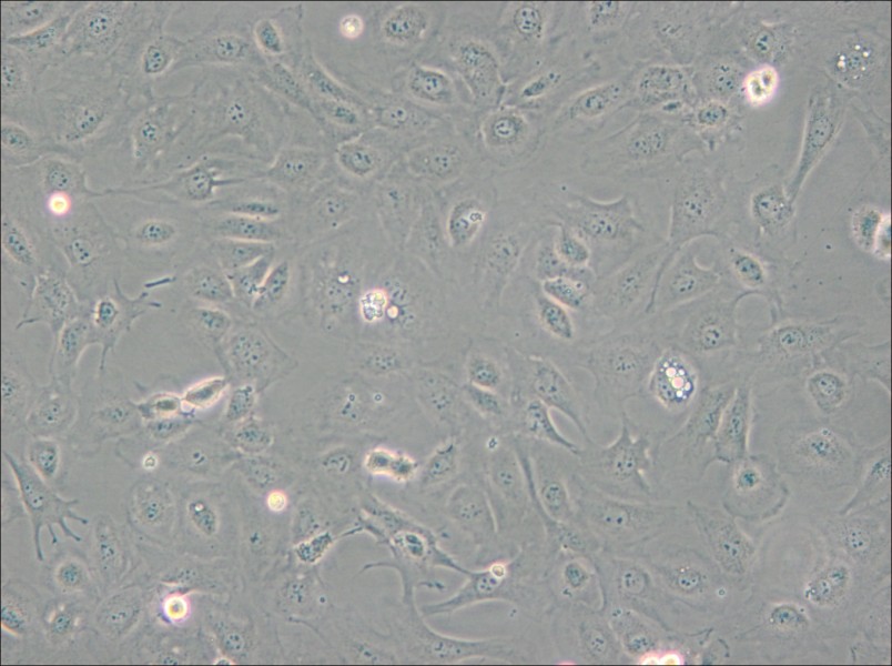 SVEC4-10 Cell Complete Medium - 5