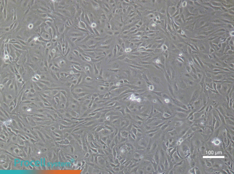 Human Lymphatic Endothelial (Primary cell immortalization) Cell Complete Medium - 1