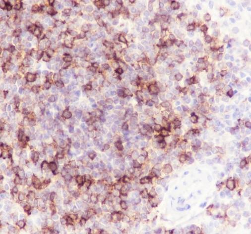 Recombinant CD1c Monoclonal Antibody - 3