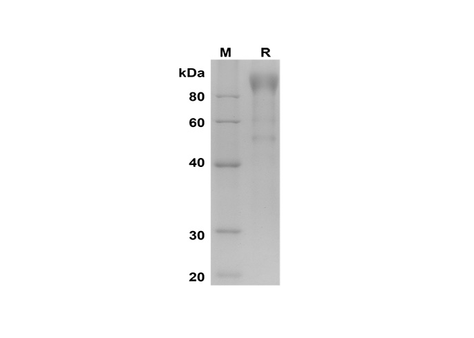 Recombinant Mouse IL-5 Protein-产品推荐-1