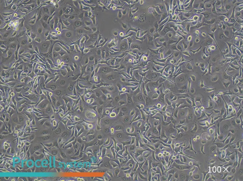 TE-1 Cell Complete Medium - 1