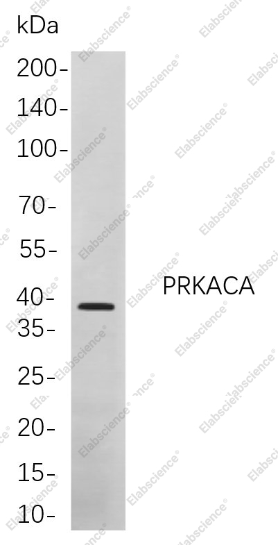 Recombinant PRKACA Monoclonal Antibody - 1