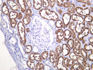 Recombinant TPO Monoclonal Antibody - 1
