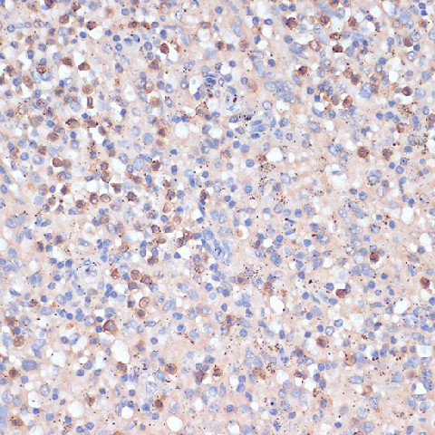 Immunohistochemistry of paraffin-embedded Human spleen using CD82 Polyclonal Antibody at dilution of  1:100 (40x lens).