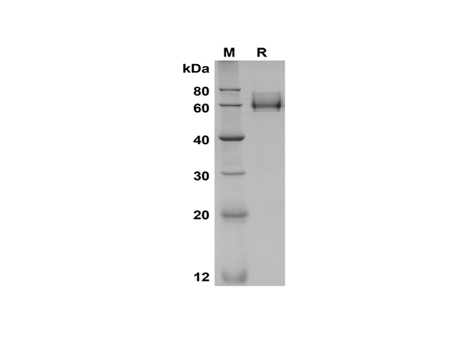 Recombinant Mouse IL-1 beta/IL1B Protein-产品推荐-4