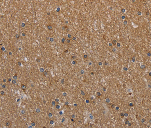 Immunohistochemistry of paraffin-embedded Human brain  tissue using NAA25 Polyclonal Antibody at dilution 1:40