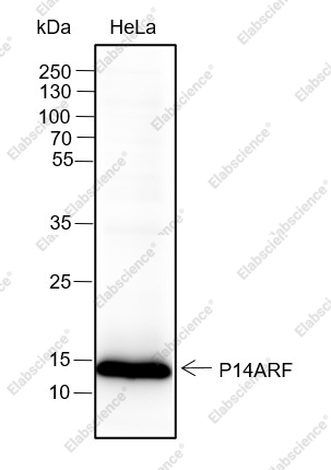 Recombinant CDKN2A/p14ARF Monoclonal Antibody - 1