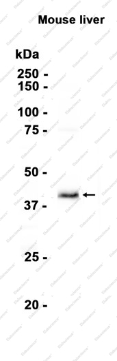 Recombinant BHMT Monoclonal Antibody - 1