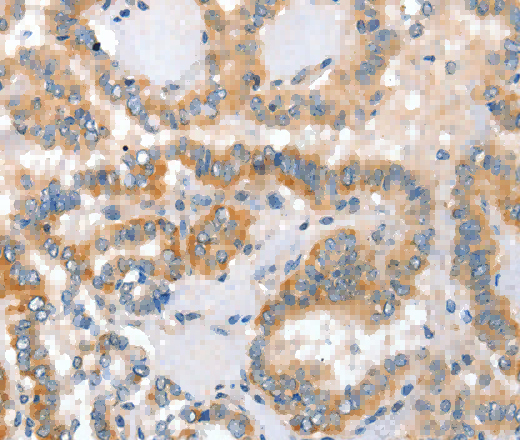 Placental Alkaline Phosphatase Polyclonal Antibody - 3