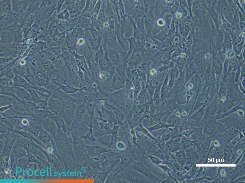 Mouse Periodontal Ligament Fibroblasts - 4
