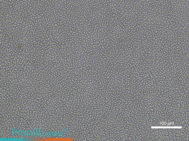 CCRF-CEM [CCRF CEM]CCRF-CEM [CCRF CEM] - 2