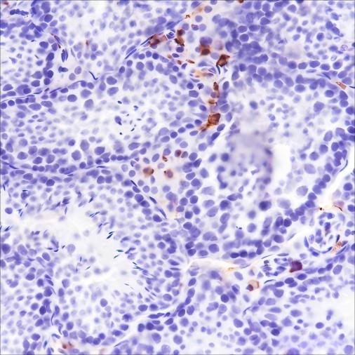 Recombinant Factor XIIIa Monoclonal Antibody - small - 4