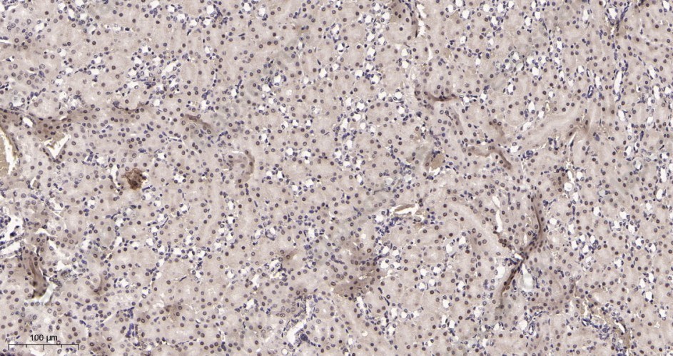 Recombinant Prohibitin Monoclonal Antibody - 3