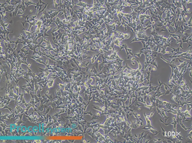 SK-N-BE(2) Cell Complete Medium - 1