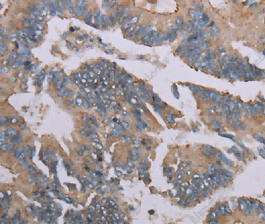 MMP20 Polyclonal Antibody - 3