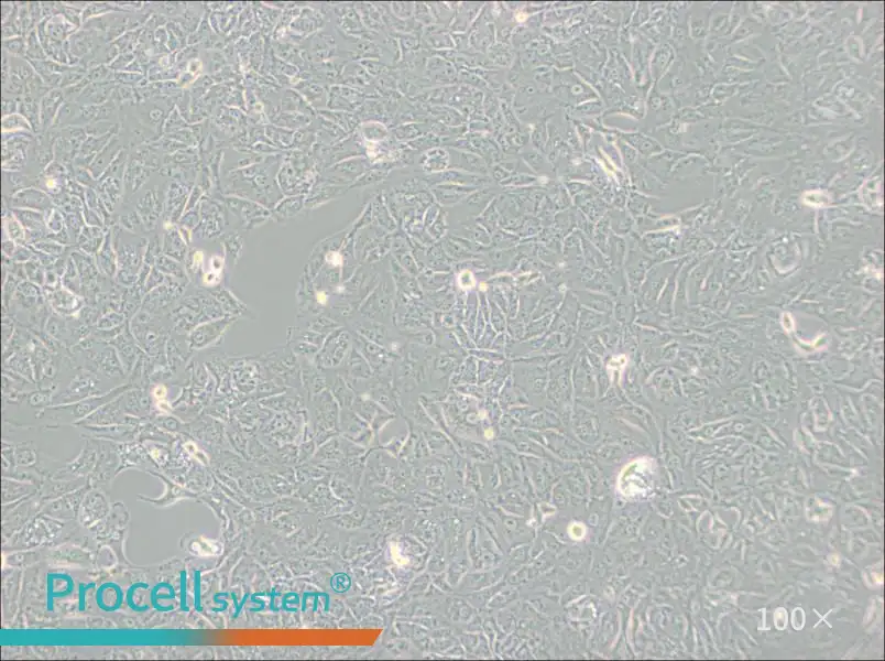 769-P Cell Complete Medium - 1