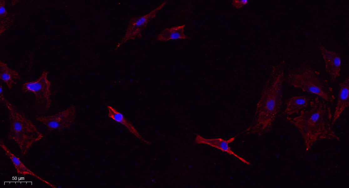 Recombinant Bax Monoclonal Antibody - small - 9