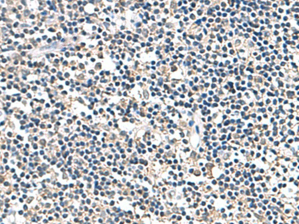 Immunohistochemistry of paraffin-embedded Human tonsil tissue  using ATP5F1D Polyclonal Antibody at dilution of 1:80(?200)