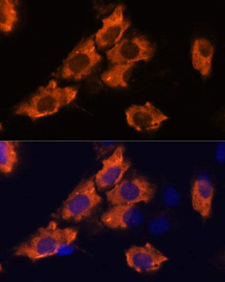 Immunofluorescence analysis of C6 cells using SEMA4A Polyclonal Antibody at dilution of 1:100. Blue: DAPI for nuclear staining.