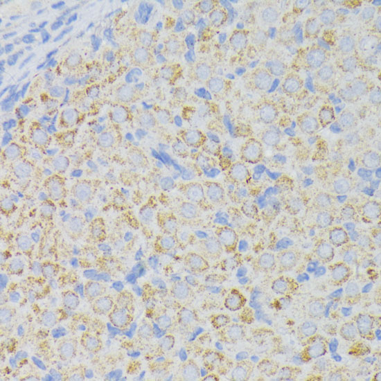 Immunohistochemistry of paraffin-embedded rat ovary using ACADL Polyclonal Antibody at dilution of 1:100 (40x lens).Perform microwave antigen retrieval with 10 mM PBS buffer pH 7.2 before commencing with IHC staining protocol.