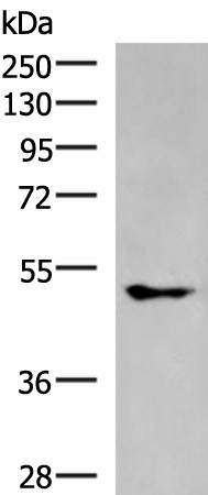 Western blot analysis of A549 cell lysate  using KCNJ2 Polyclonal Antibody at dilution of 1:550