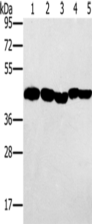 Western Blot analysis of Hela, skov3 and A549 cell, Mouse liver and Human ovarian cancer tissue using PON1 Polyclonal Antibody at dilution of 1:500