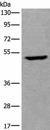 Western blot analysis of Human fetal liver tissue lysate  using UMPS Polyclonal Antibody at dilution of 1:400