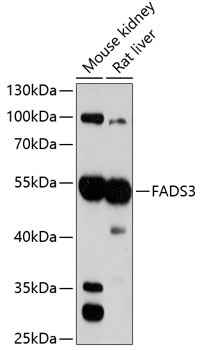 Western blot analysis of extracts of various cell lines using FADS3 Polyclonal Antibody at 1:3000 dilution.