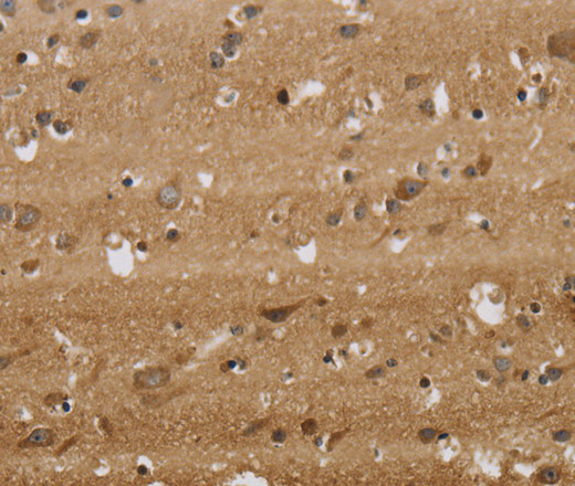 Immunohistochemistry of paraffin-embedded Human brain  tissue using KCNMB2 Polyclonal Antibody at dilution 1:40