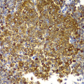 Immunohistochemistry of paraffin-embedded Rat spleen using TLR2 Polyclonal Antibody at dilution of 1:100 (40x lens).