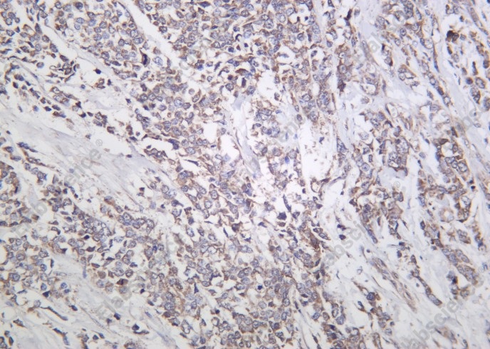 Recombinant Actinin-α1 Monoclonal Antibody - 1
