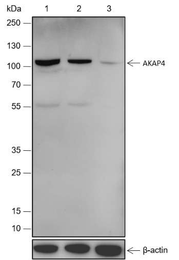 Recombinant AKAP4 Monoclonal Antibody - small - 1