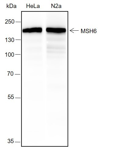 Recombinant MSH6 Monoclonal Antibody-searchlist-1