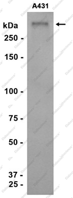 Recombinant Desmoplakin Monoclonal Antibody - 1