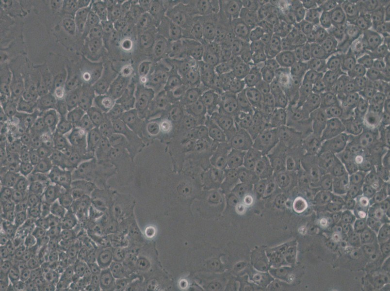 SACC-83 Cell Complete Medium - 5