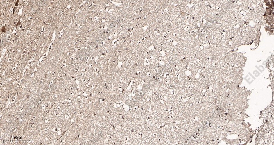 Recombinant S6K1 Monoclonal Antibody - 3