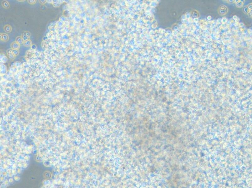 NCI-H2171 Cell Complete Medium - 4