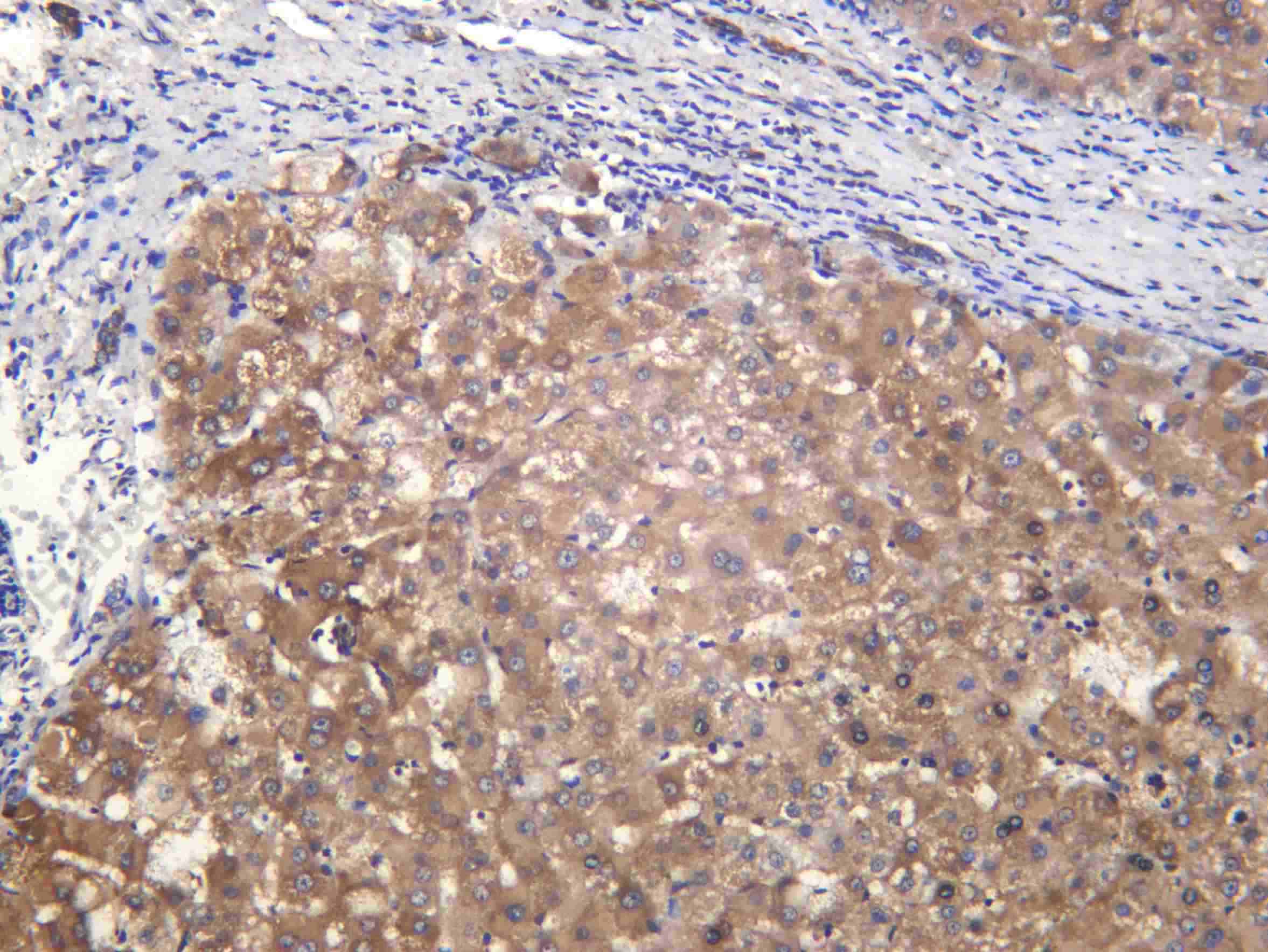 Recombinant Citrate Synthetase Monoclonal Antibody - 2