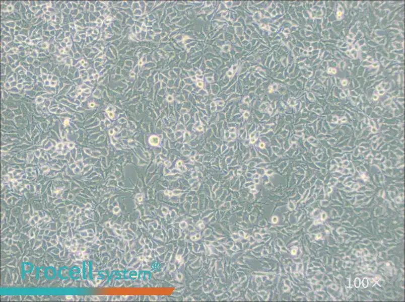 NCI-H3122 Cell Complete Medium - 2