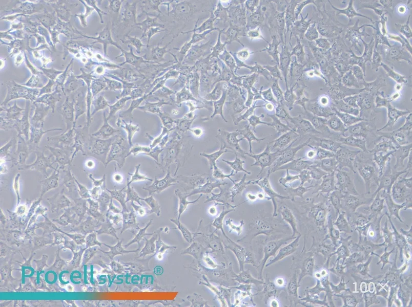 Hs 578T Cell Complete Medium - 2