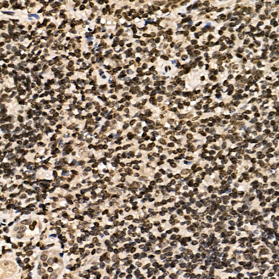 Immunohistochemistry of paraffin-embedded human tonsil using ERCC6 Polyclonal Antibody at dilution of 1:100 (40x lens).Perform microwave antigen retrieval with 10 mM PBS buffer pH 7.2 before commencing with IHC staining protocol.