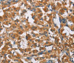 COPB1 Polyclonal Antibody - 2